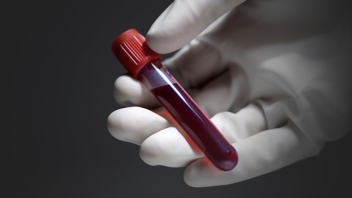 narcotics-blood-test